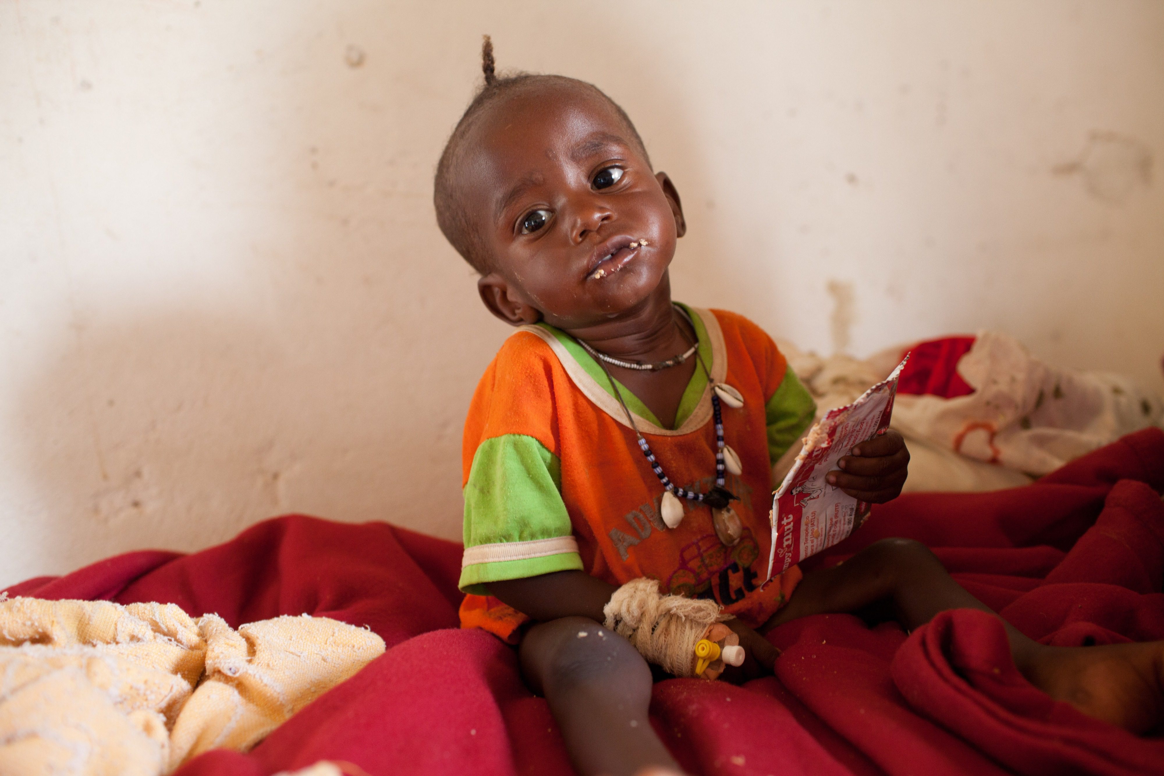 Unterernährung-Kind-Tschad