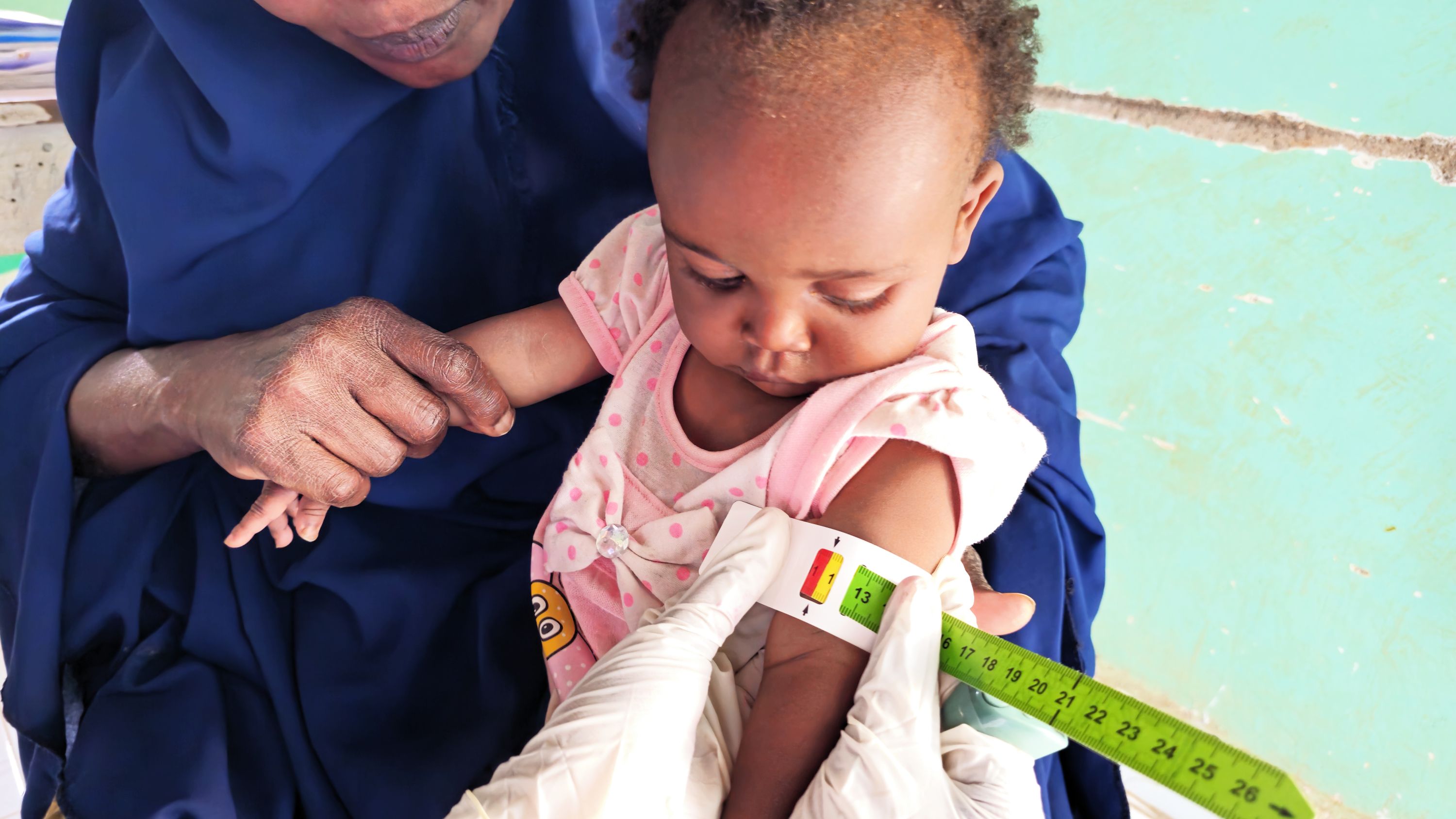 SomaliaHungerMUAC